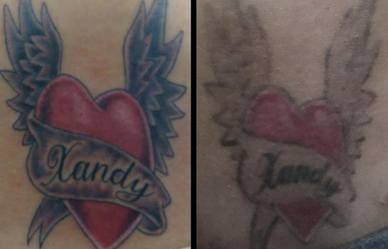 Jaca falou também sobre sessões para apagar tatuagens que homenageia o ex (Foto: Reprodução/Instagram)
